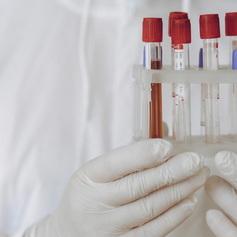 Why Do Providers Order So Many Lab Tests?