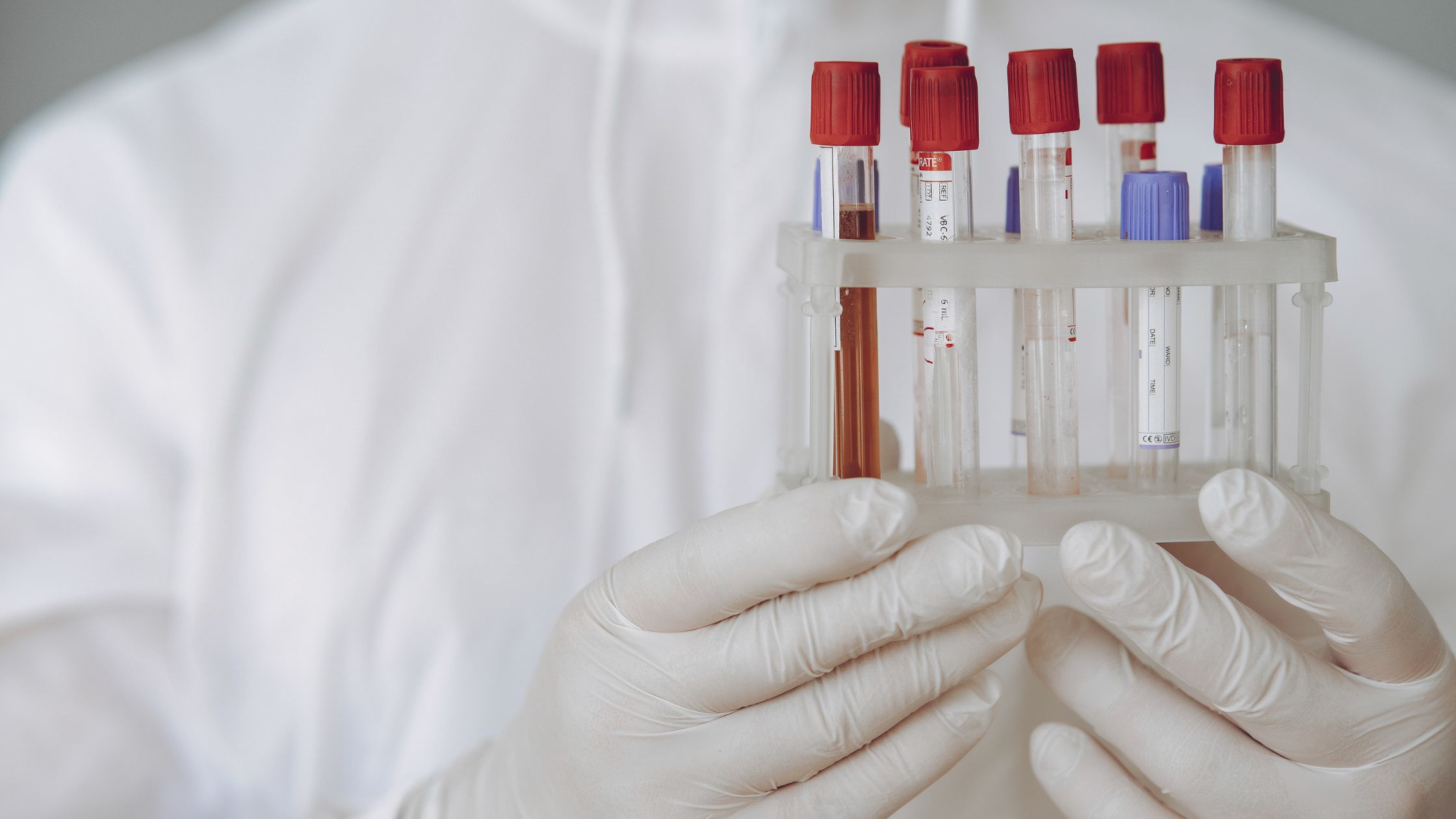 Why Do Providers Order So Many Lab Tests?
